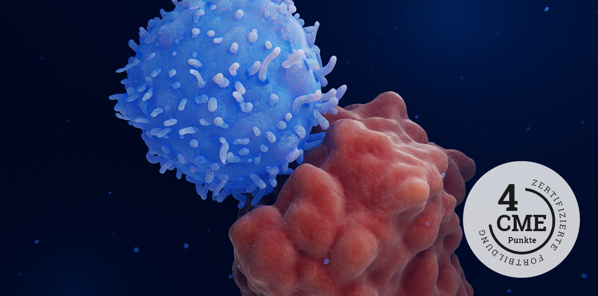 CME zu neuen Therapien bei Lymphdrüsenkrebs