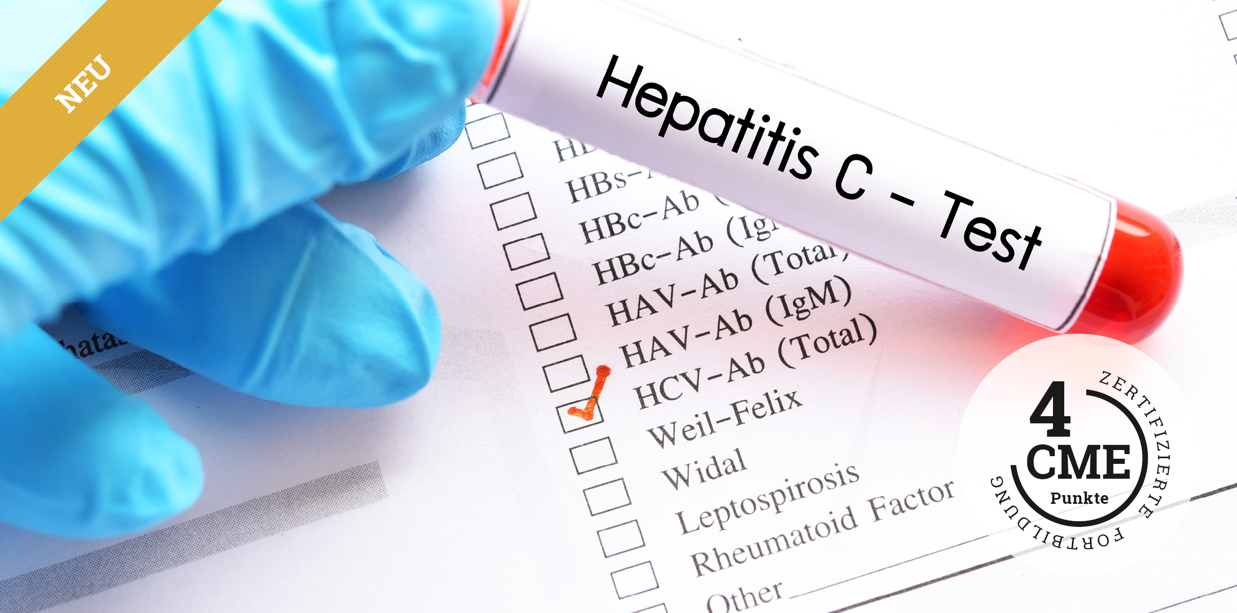 CME zu Hepatitis C bei Drogenkonsum