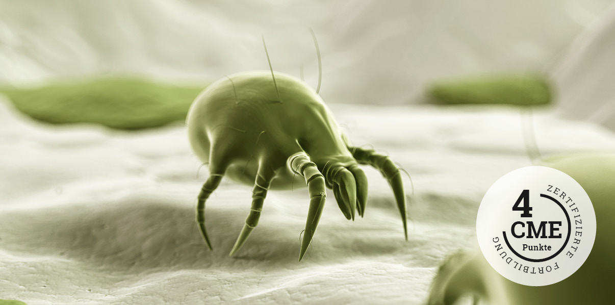CME-Fortbildung zu Therapien bei Allergie gegen Hausstaubmilben
