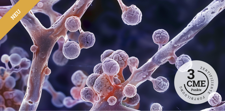 CME zur Gichtarthritis/Arthritis