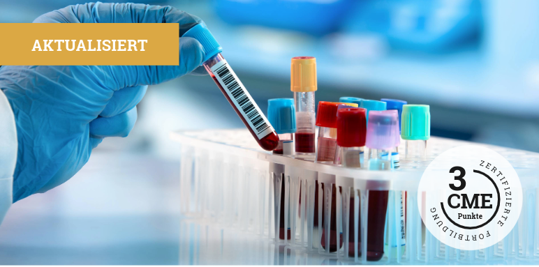 CME-Fortbildung zu sNfL als Biomarker bei der Multiplen Sklerose