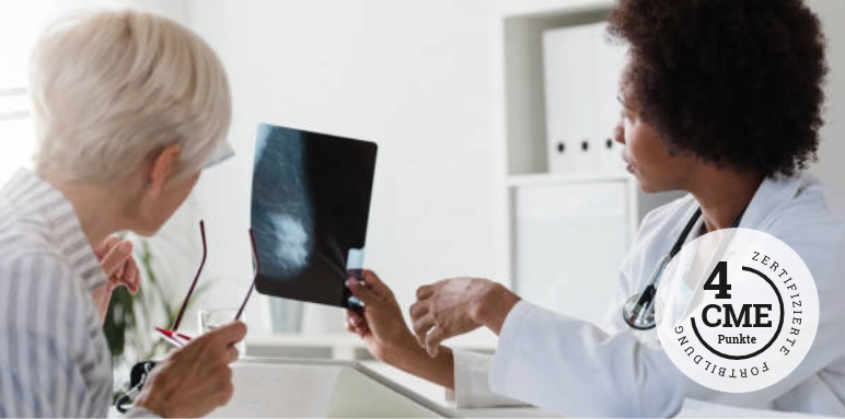 CME-Fortbildung zu Shared Decision Making in der Therapie des Mammakarzinoms