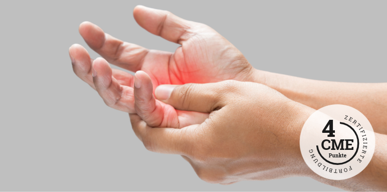 CME-Fortbildung zu Allergien bei Kindern