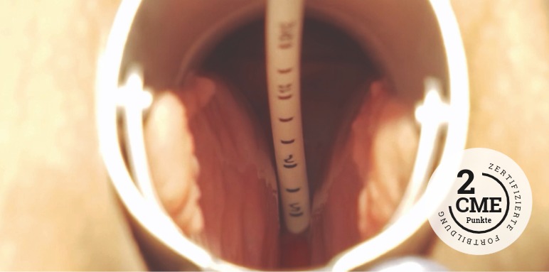 CME-Fortbildung zu Shared Decision Making in der Therapie des Mammakarzinoms