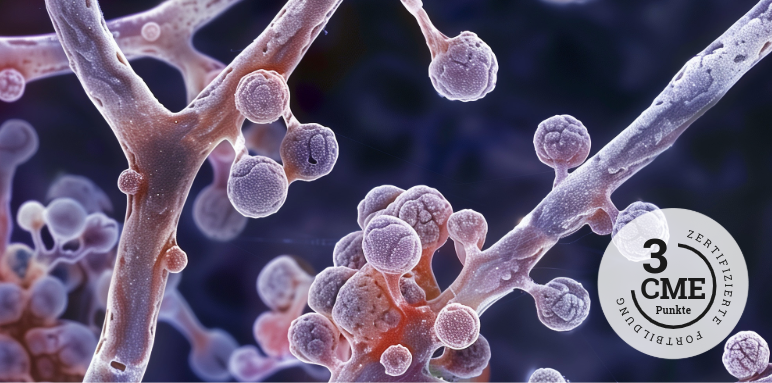 CME-Fortbildung zu Shared Decision Making in der Therapie des Mammakarzinoms