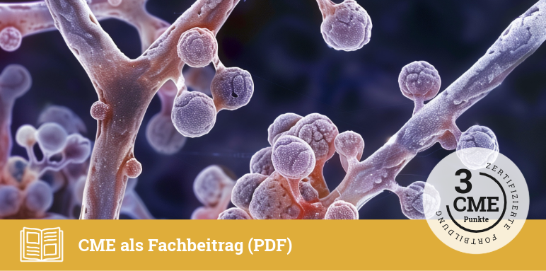 Nicht-invasive Candidosen im Fokus: Wissenswertes und Entwicklungen