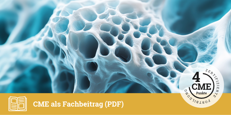 5129_Titelbild_osteoanabole-Therapie Keine Angst vor osteoanaboler Therapie: eine wichtige Behandlungsoption bei Osteoporose