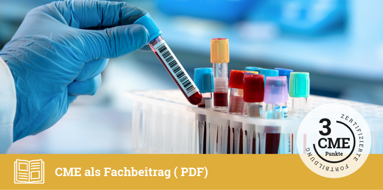 <br />
Neurofilament-Leichtketten im Serum (sNfL) als Biomarker<br />
bei der Multiplen Sklerose