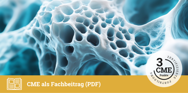 Ambulantes Therapiemanagement mit CDK4/6-Inhibitoren beim frühen Mammakarzinom